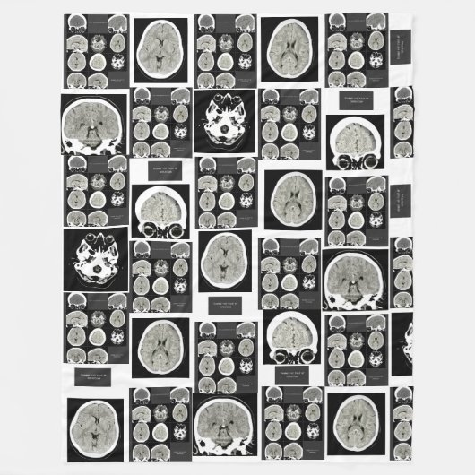 CT Scan_this is depression_CTFOD Fleecedecke (Vorderseite)