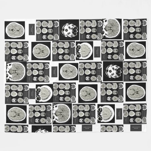 CT Scan_this is depression_CTFOD Fleecedecke (Vorderseite (Horizontal))