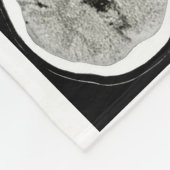 CT Scan_this is depression_CTFOD Fleecedecke (Ecke)