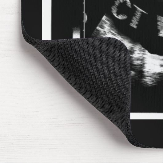 CT Well Mousepade  (CT Well im Bauch) Mousepad (Ecke)