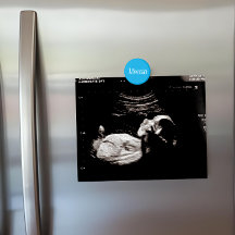 Custom Azure Blue Name Ultrasound Display Kühlschr