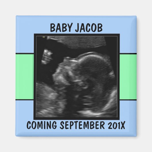 Custom Baby Boy Ultrasound Foto Magnet (Vorne)