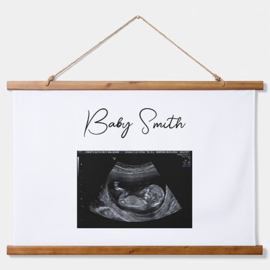 Custom Baby Sonogram Ultrasound Wood Topped Wandteppich Mit Holzrahmen (Vorne)