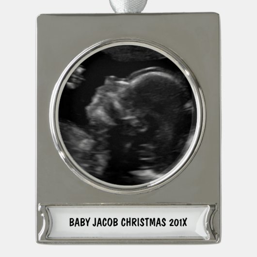 Custom Baby Ultrasound Foto Banner-Ornament Silber (Vorderseite)