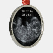 Custom Baby Ultrasound Foto Ornament Aus Metall (Rechts)