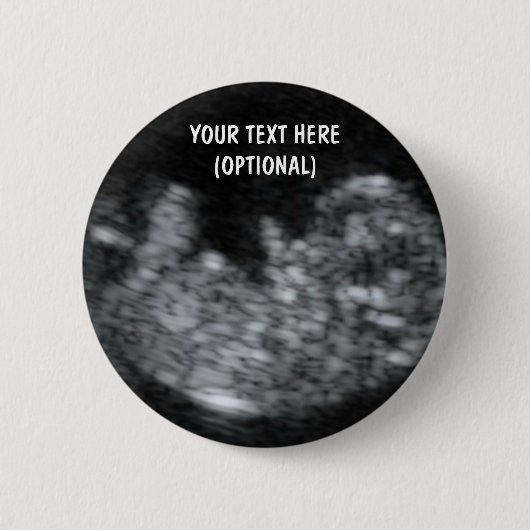 Custom Baby Ultrasound Picture Button (Vorderseite)