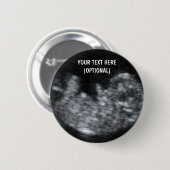 Custom Baby Ultrasound Picture Button (Vorne & Hinten)