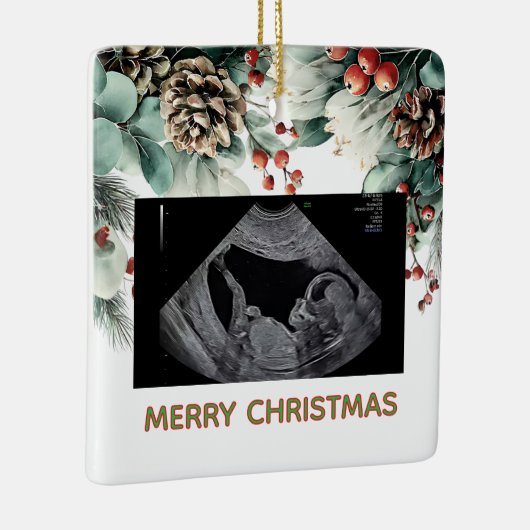 Custom First Christmas Expecting Photo Ornament (Rechts)