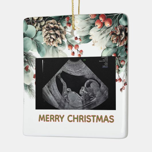 Custom First Christmas Expecting Photo Ornament (Links)
