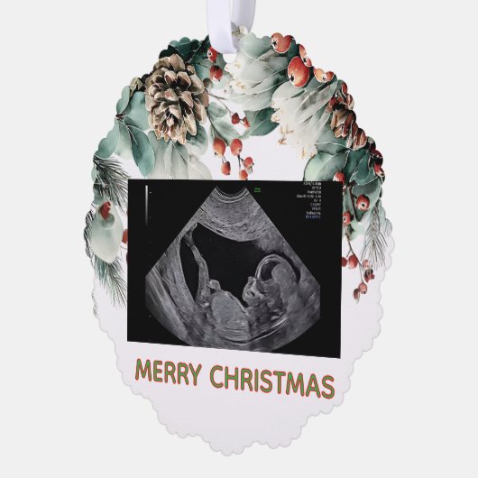 Custom First Christmas Expecting Photo Ornament (Links)