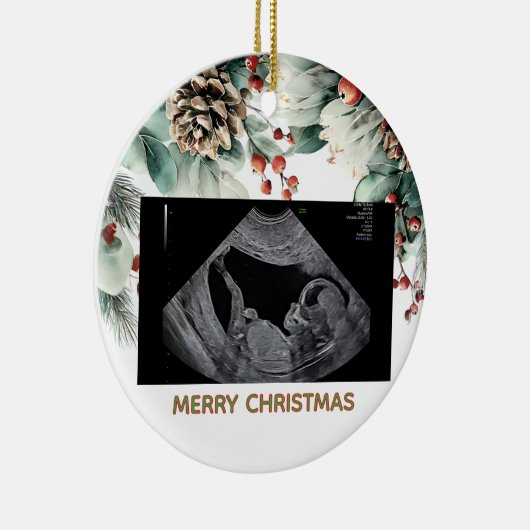 Custom First Christmas Expecting Photo Ornament (Rechts)