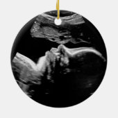 Custom Ultrasound 1. Weihnachten Keramik Ornament (Hinten)