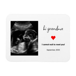 Custom Ultrasound Foto Geschenk für Oma, Opa Magnet