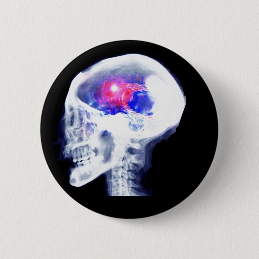 Cyborg-Gehirn Button (Vorderseite)