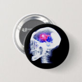 Cyborg-Gehirn Button (Vorne & Hinten)