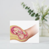 Darstellung der Lieferung von Fetus 2 Postkarte (Stehend Vorderseite)