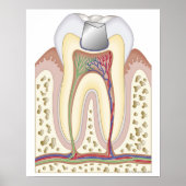 Darstellung der Zahnfülle Poster (Vorne)