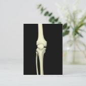 Darstellung des Knie-Knochens, gerade Postkarte (Stehend Vorderseite)