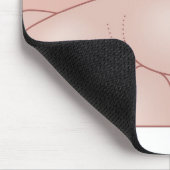 Darstellung einer Hernie Mousepad (Ecke)