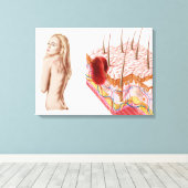 Darstellung eines atypischen Hautwachstums Leinwanddruck (Insitu (Holzboden))