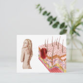 Darstellung eines atypischen Hautwachstums Postkarte (Stehend Vorderseite)