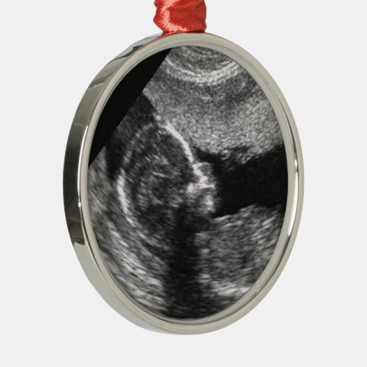 Das 1. Weihnachten des Babys Ornament Aus Metall (Rechts)