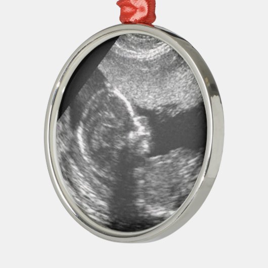 Das 1. Weihnachten des Babys Ornament Aus Metall (Links)