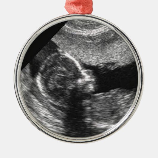 Das 1. Weihnachten des Babys Ornament Aus Metall (Vorne)