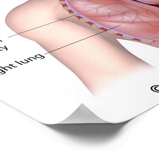 Das Atemsystem mit Plakat (Ecke)