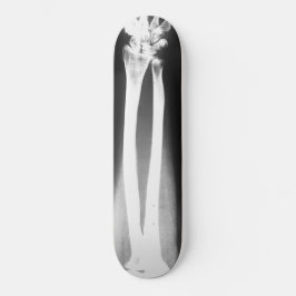 Das Breaks-Skateboard von Bradley Boness Skateboard