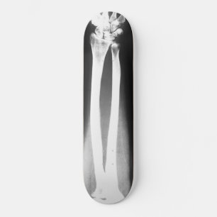 Das Breaks-Skateboard von Bradley Boness Skateboard