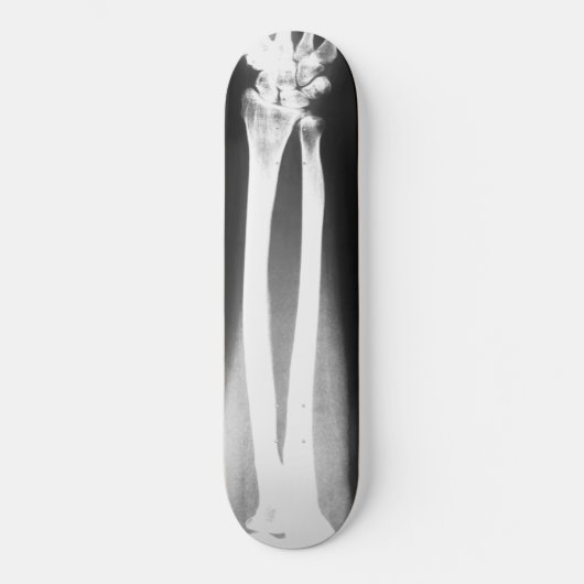 Das Breaks-Skateboard von Bradley Boness Skateboard (Vorderseite)