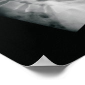 Das Chiropraktiker-Filmplakat Poster (Ecke)