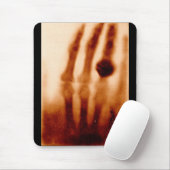 Das erste Röntgenbild, 1901, Fotografie Mousepad (Mit Mouse)