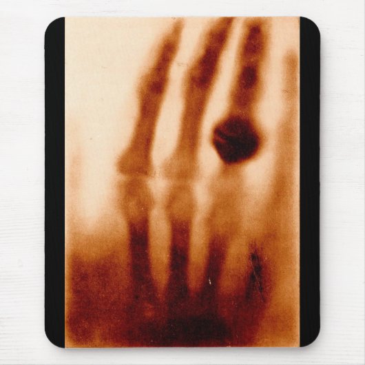 Das erste Röntgenbild, 1901, Fotografie Mousepad (Vorne)