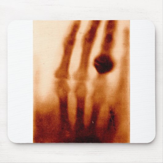 Das erste Röntgenbild, 1901, Fotografie Mousepad (Vorne)