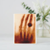Das erste X-Ray, 1901, Foto Postkarte (Stehend Vorderseite)