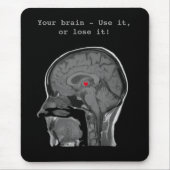 Das menschliche Gehirn - Mousepad (Vorne)