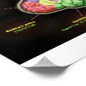 Das MUSLIMISCHE BRAIN-Poster Poster (Ecke)