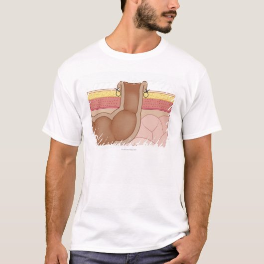 Dauerhafter Colostomy T-Shirt (Vorderseite)