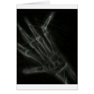 Defekter Handröntgenstrahl