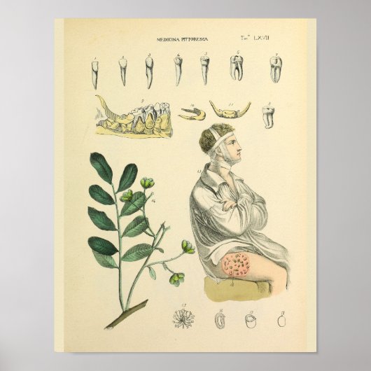 Dental Teeth Jaw Vintag Anatomie Art Print Poster (Vorne)