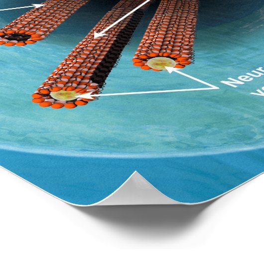 Desintegration der Mikrotubuli in einem Neuron Poster (Ecke)