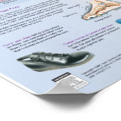 Diabetes Fotopapster - Netter-Diagramm Poster (Ecke)