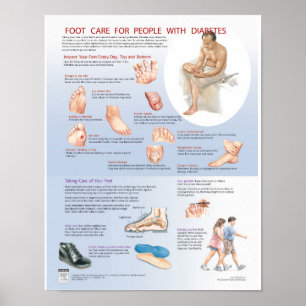 Diabetes-Fuß-Sorgfalt-Plakat - Netter-Diagramm Poster