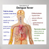 Diagramm der Hauptsymptome des Dengue-Fiebers Poster (Vorne)