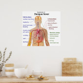 Diagramm der Hauptsymptome des Dengue-Fiebers Poster (Küche)