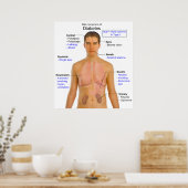 Diagramm der Hauptsymptome des Diabetes beim Mensc Poster (Küche)