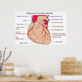 Diagramm der koronaren Arterien eines menschlichen Poster (Küche)
