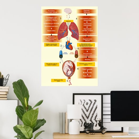 Diagramm eines amniotischen Flüssigkeitsembolismus Poster (Heimbüro)